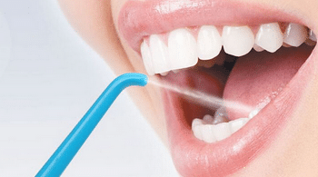 Avantages du jet dentaire
